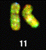 Human Chromosomes 11 & 20