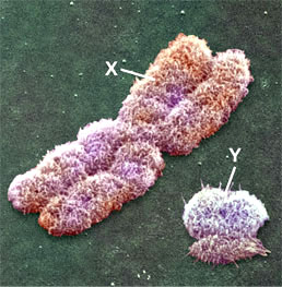 Y chromosome